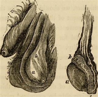 Infertility Statistics Worldwide 2018 Pdf