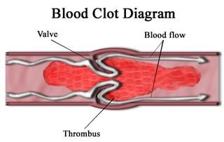 Ivm Process Infertility