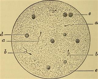 Unexplained Infertility Never Been Pregnant