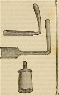 Infertility in Cushing's