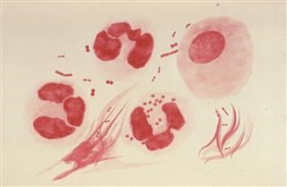 Infertility Full Blood Count