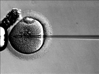 Family History of Infertility Icd 10