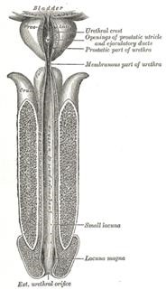 Female Infertility Disease