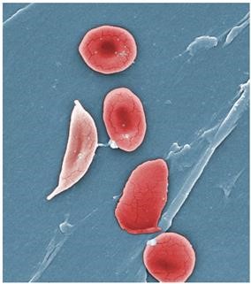 Female Infertility Radiographics