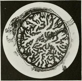 Infertility Signs Tagalog