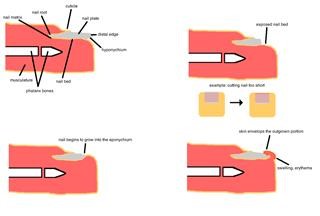 Different Infertility Diagnosis