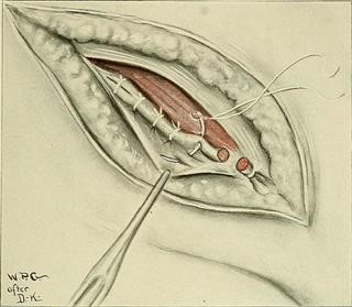 Oncology Nurses Infertility