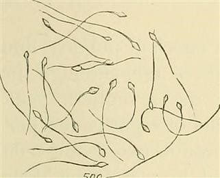 Latest Infertility Treatment for Pcos