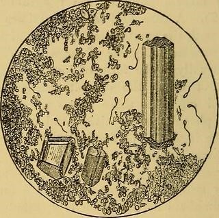 Birth Control Use for Infertility