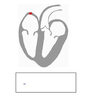 Laparoscopy Infertility Ppt