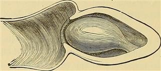 Infertility Management Nice Guidelines