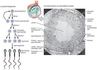 Female Infertility Causes Ovarian