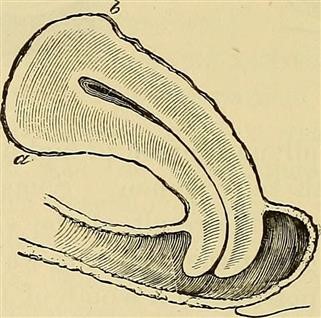 Infertility Cause Endometrium