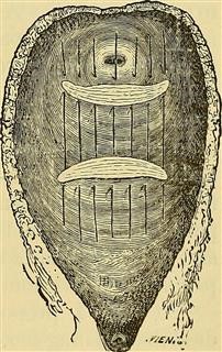 Infertility Treatment Duration