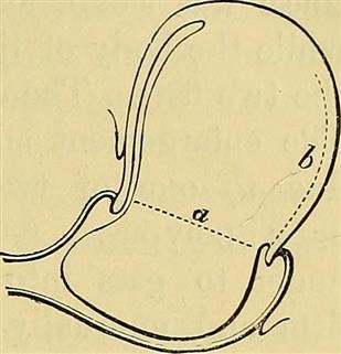 Infertility Investigations