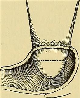 Birth Control Shot Cause Infertility