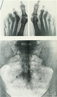 Infertility X Ray