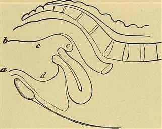 Infertility and Pcos Getting Pregnant