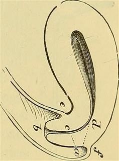 Infertility Prevalence Needs Assessment and Purchasing