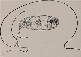 Issues of Infertility