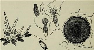 Infertility Pain Icd 10