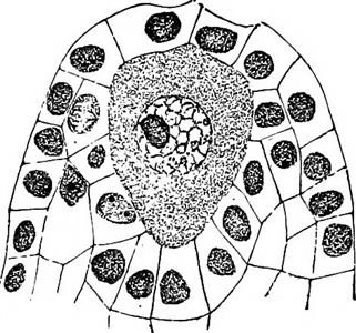 Infertility Concerns Icd 10