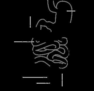 Infertility Treatment Regimen