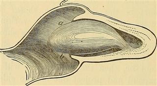 Modifiable Risk Factors for Infertility