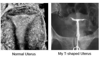 Arc Infertility Hospital Kerala